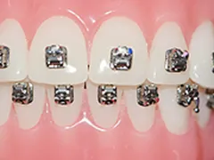 5. メタルブラケット