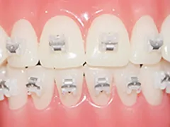 エンパワーブラケット